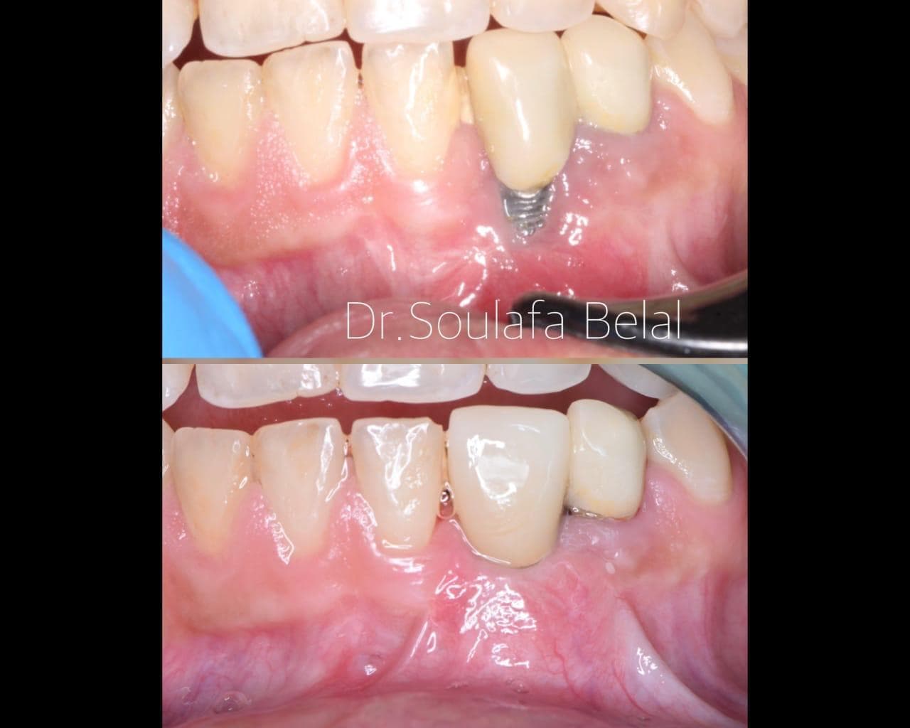 Case 4