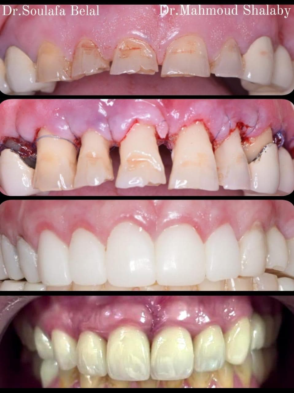 Case 5