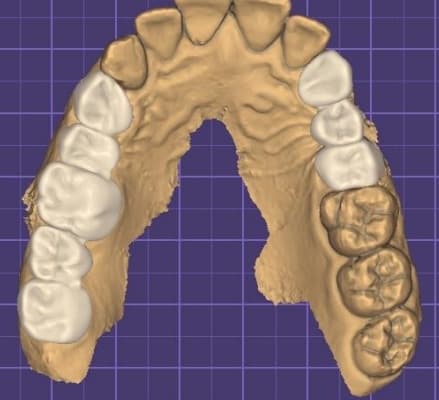 حالة 3